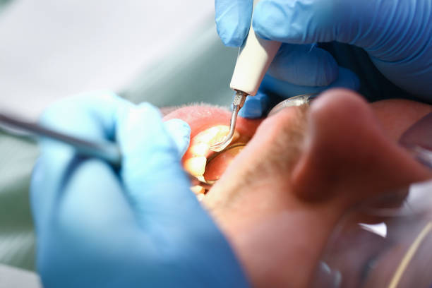 Best Emergency Treatment for Toothache in South Barrington, IL